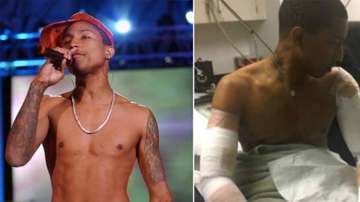 Pharrell Tattoo Removal
